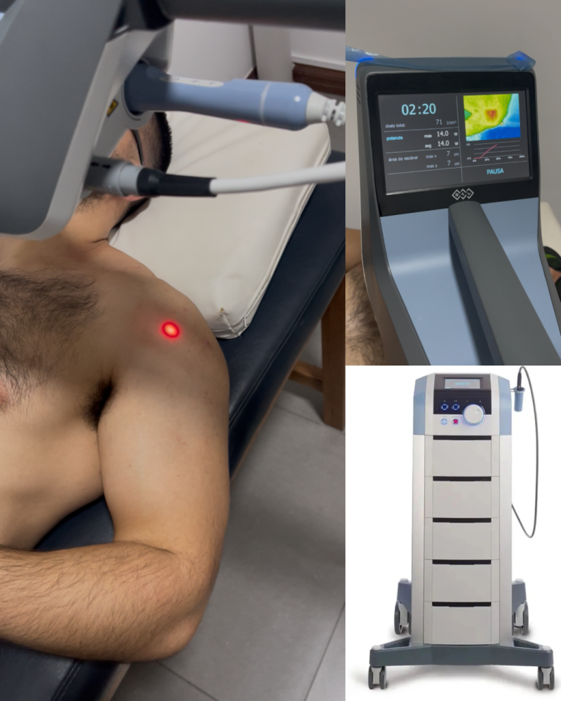 El HIL ofrece un tratamiento potente para el dolor, su característica es la penetración profunda en los tejidos y su capacidad para estimular la actividad celular promoviéndotelas la cicatrización . Emplea niveles de potencia significativamente mas altos que la laserterapia convencional llegando a tejidos profundos con mayor efecto terapéutico .